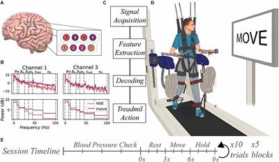 Brain-Computer interface control of stepping from invasive electrocorticography upper-limb motor imagery in a patient with quadriplegia